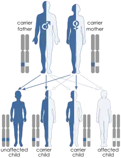 Illustration of autosomal recessive inheritance. Each parent has one blue allele and one white allele. Each of their 4 children inherit one allele from each parent such that one child ends up with two blue alleles, one child has two white alleles and two children have one of each allele. Only the child with both blue alleles shows the trait because the trait is recessive.