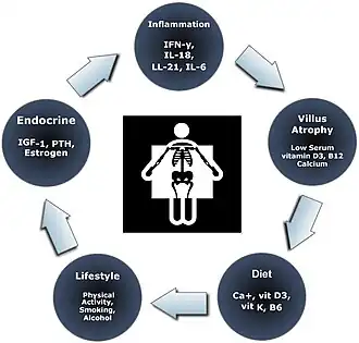 A visual explaining the mechanisms for bone manifestations of coeliac disease