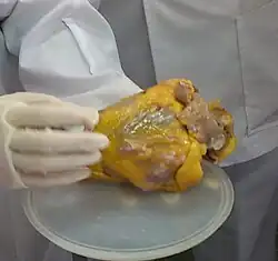 Image of a heart appearing enlarged