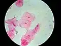 Human cheek cells (nonkeratinized stratified squamous epithelium) 500×