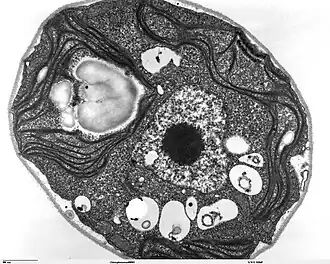 Transmission electron micrograph of Chlamydomonas reinhardtii, a green alga that contains a pyrenoid surrounded by starch.