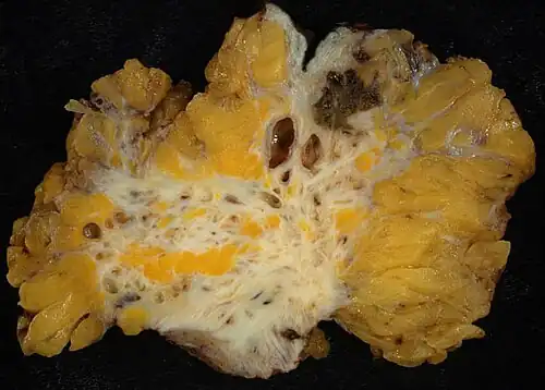 yellow-white adbdominal wall with dark spots