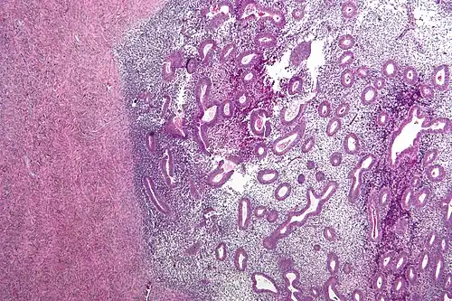 Purple microscope image showing two types of tissue
