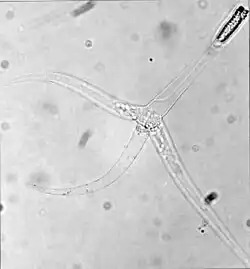 Myxozoans such as Myxobolus cerebralis are single-celled parasites, never more than 20 μm across.