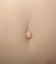 An outie navel