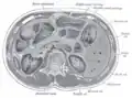 Transverse section through the middle of the first lumbar vertebra, showing the relations of the pancreas
