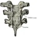 Vertebral arches of three thoracic vertebrae