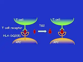 A visual graphic showing how peptides bind in coeliac disease and healthy individuals