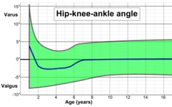 Hip-knee-ankle angle by age, with 95% prediction interval.[40]