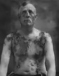 German American farmer John Meints of Minnesota was tarred and feathered in August 1918 for allegedly not supporting war bond drives.