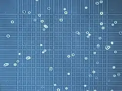 A microscopic image showing numerous cells overlaid on a grid