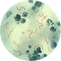 Streptococcus pyogenes